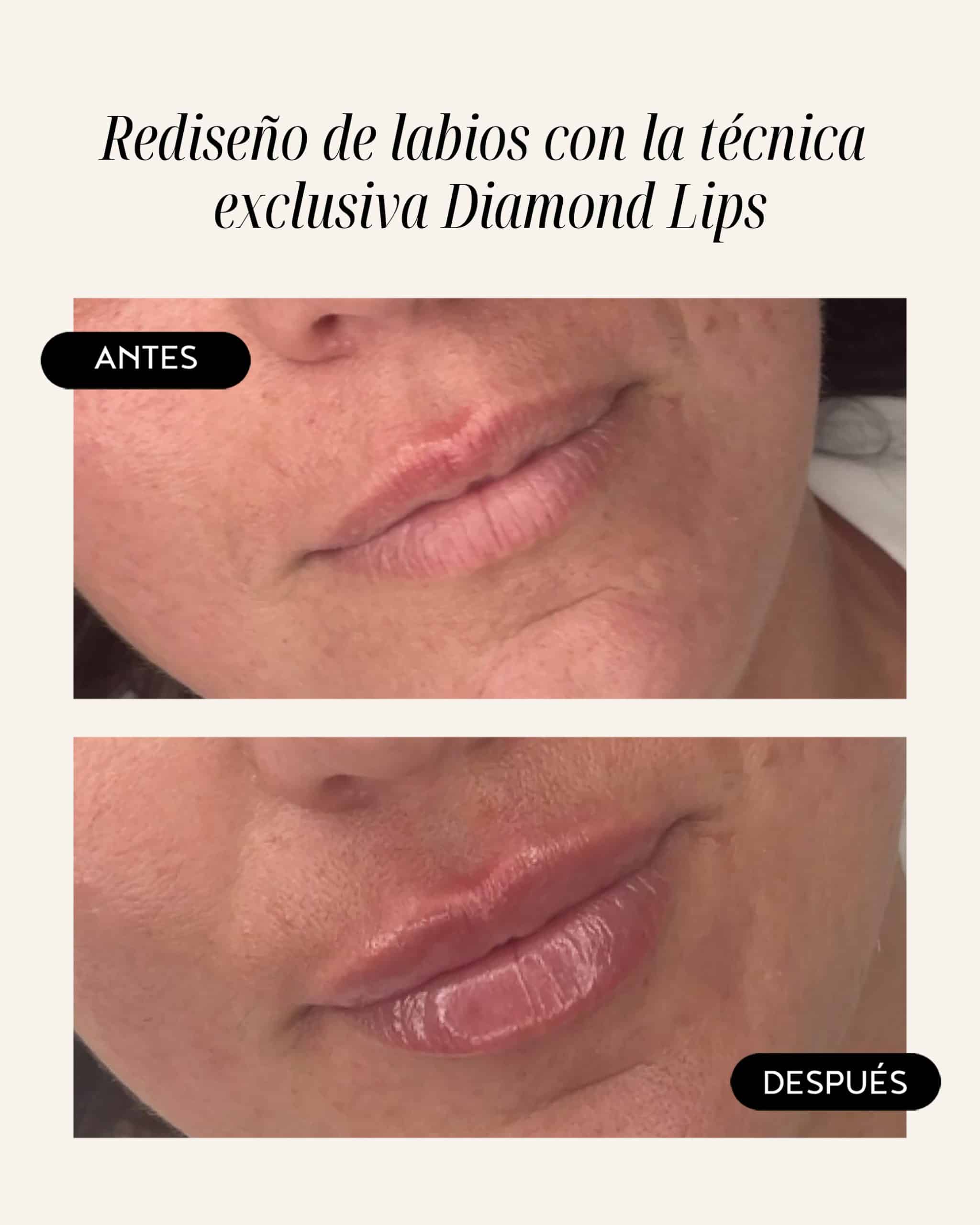 diamond-lips-01