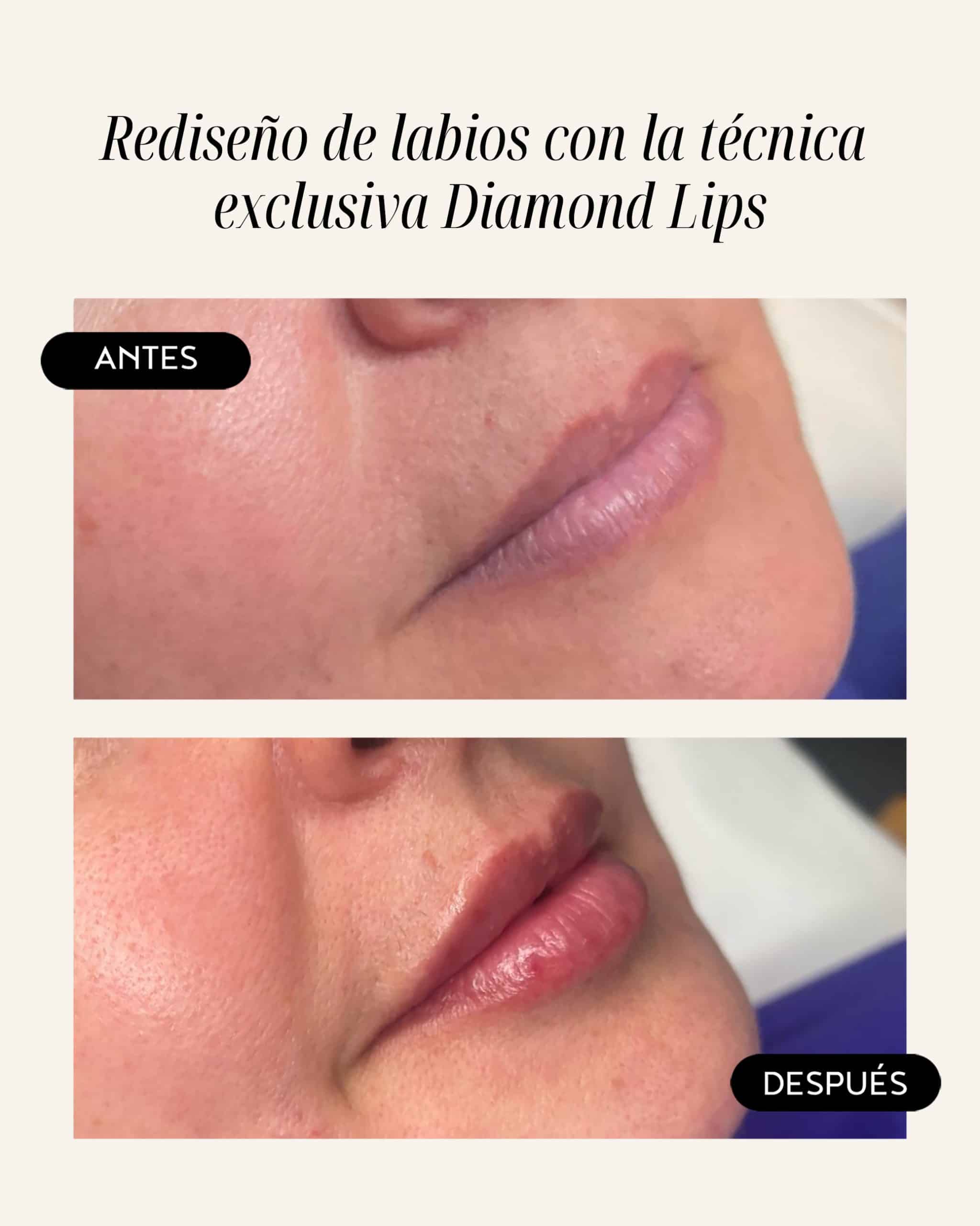 diamond-lips-02