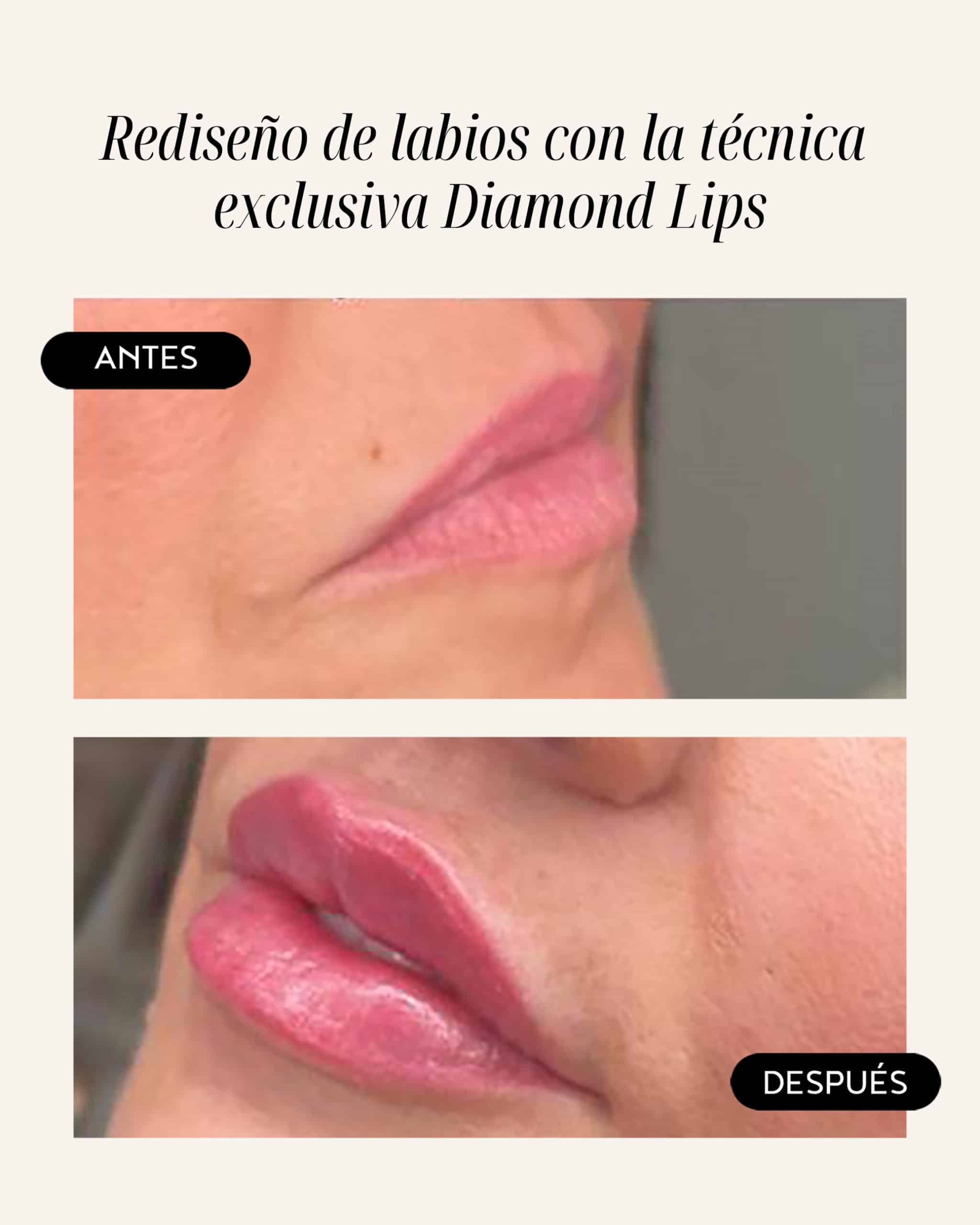 diamond-lips-03