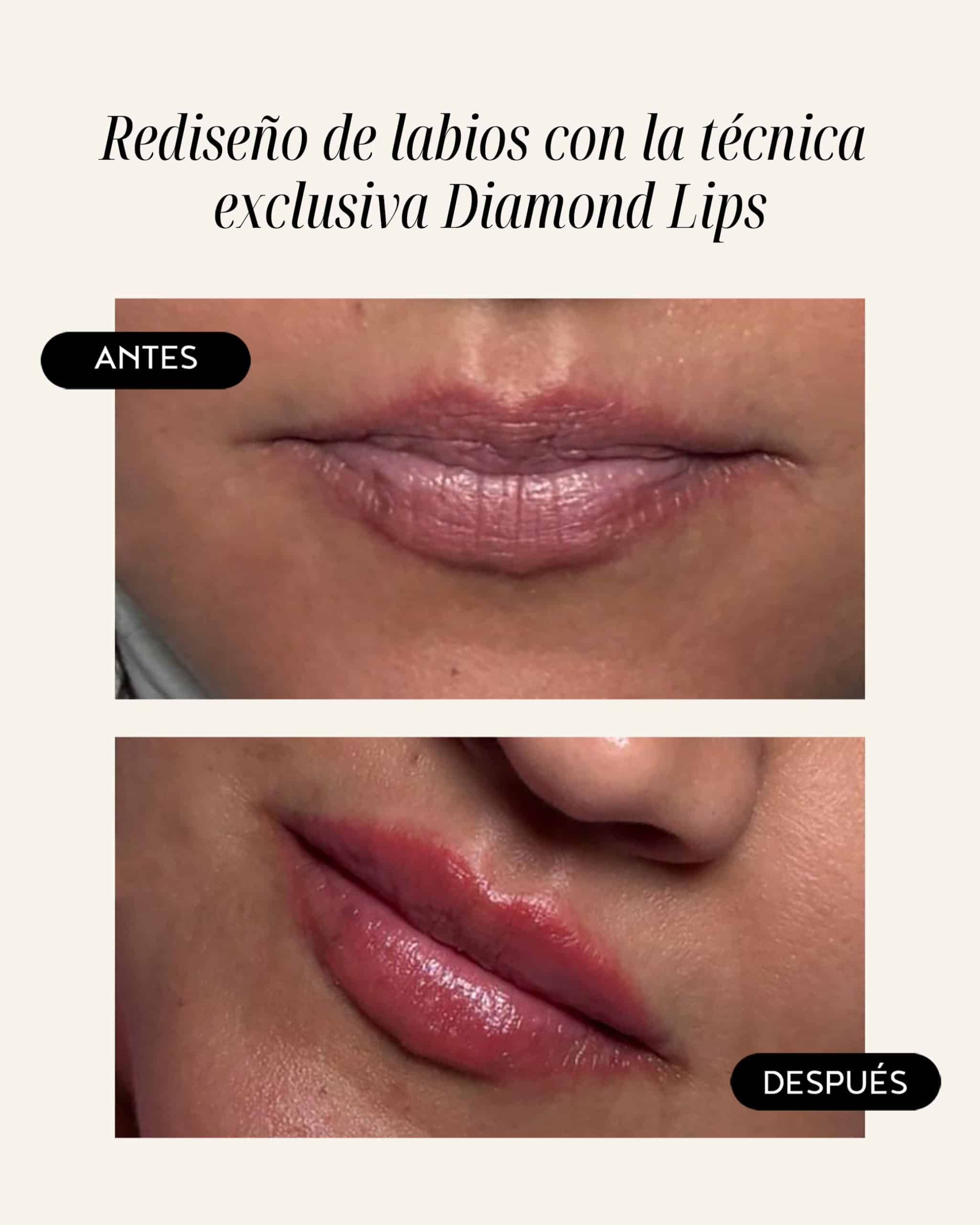 diamond-lips-04