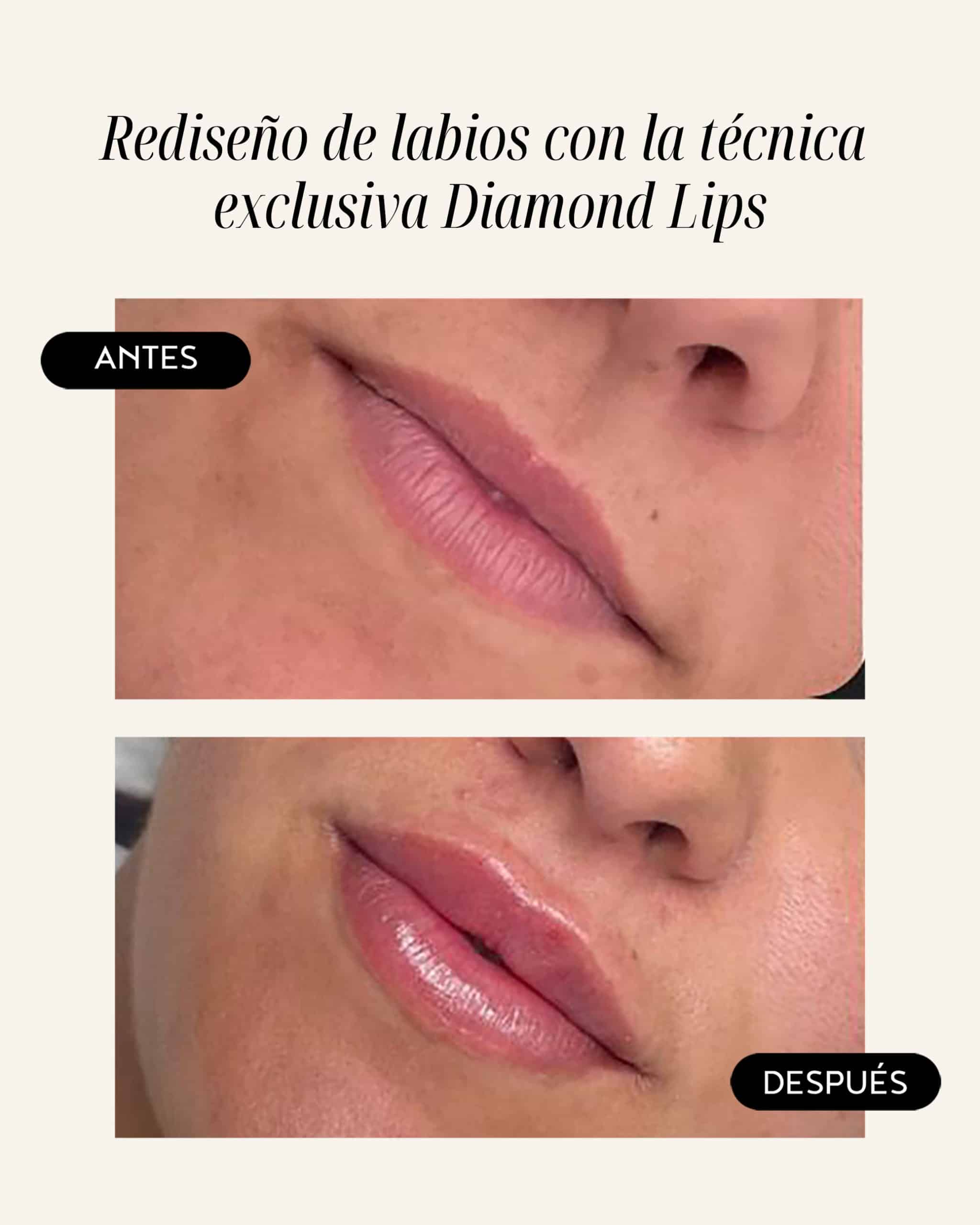 diamond-lips-05
