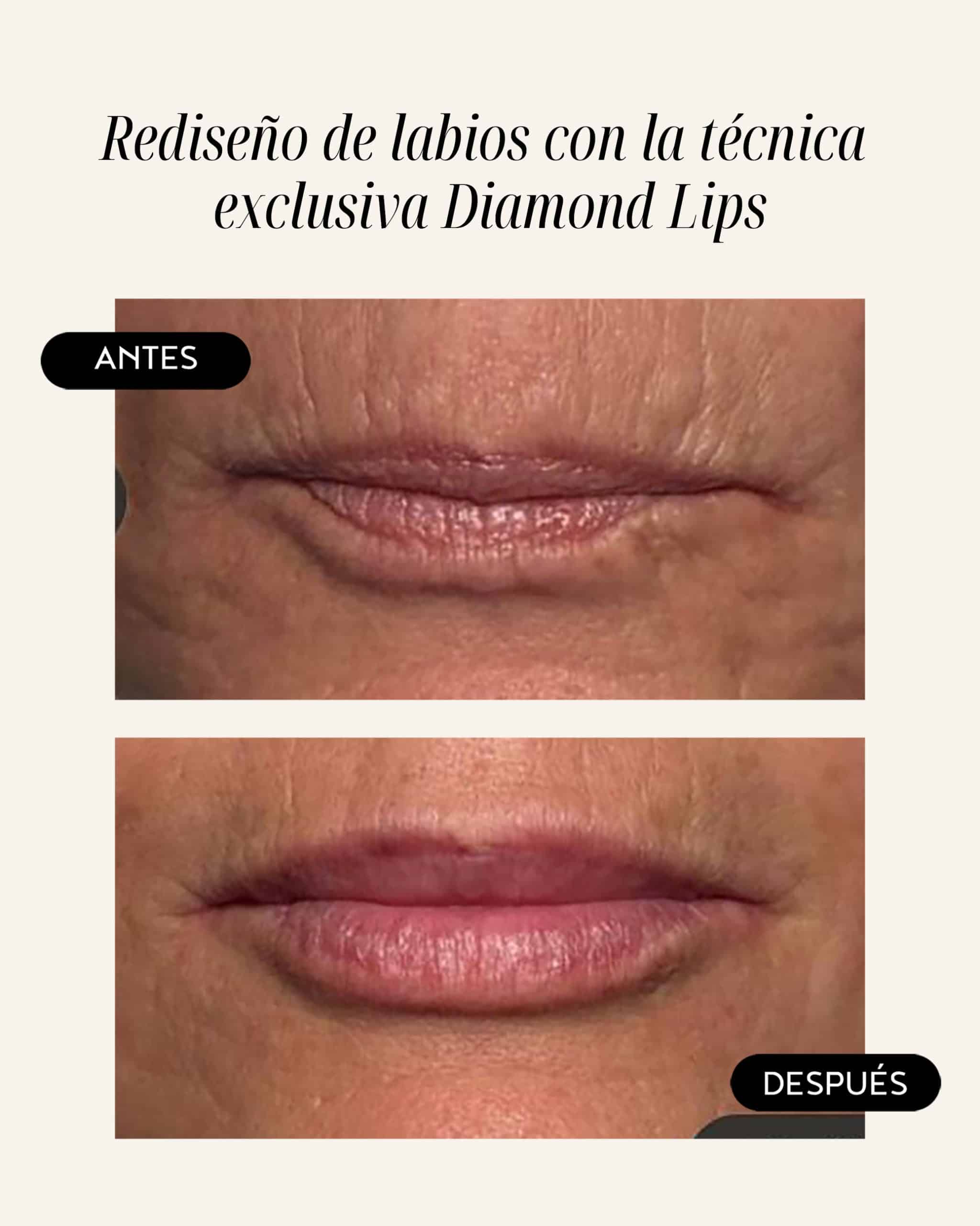 diamond-lips-06