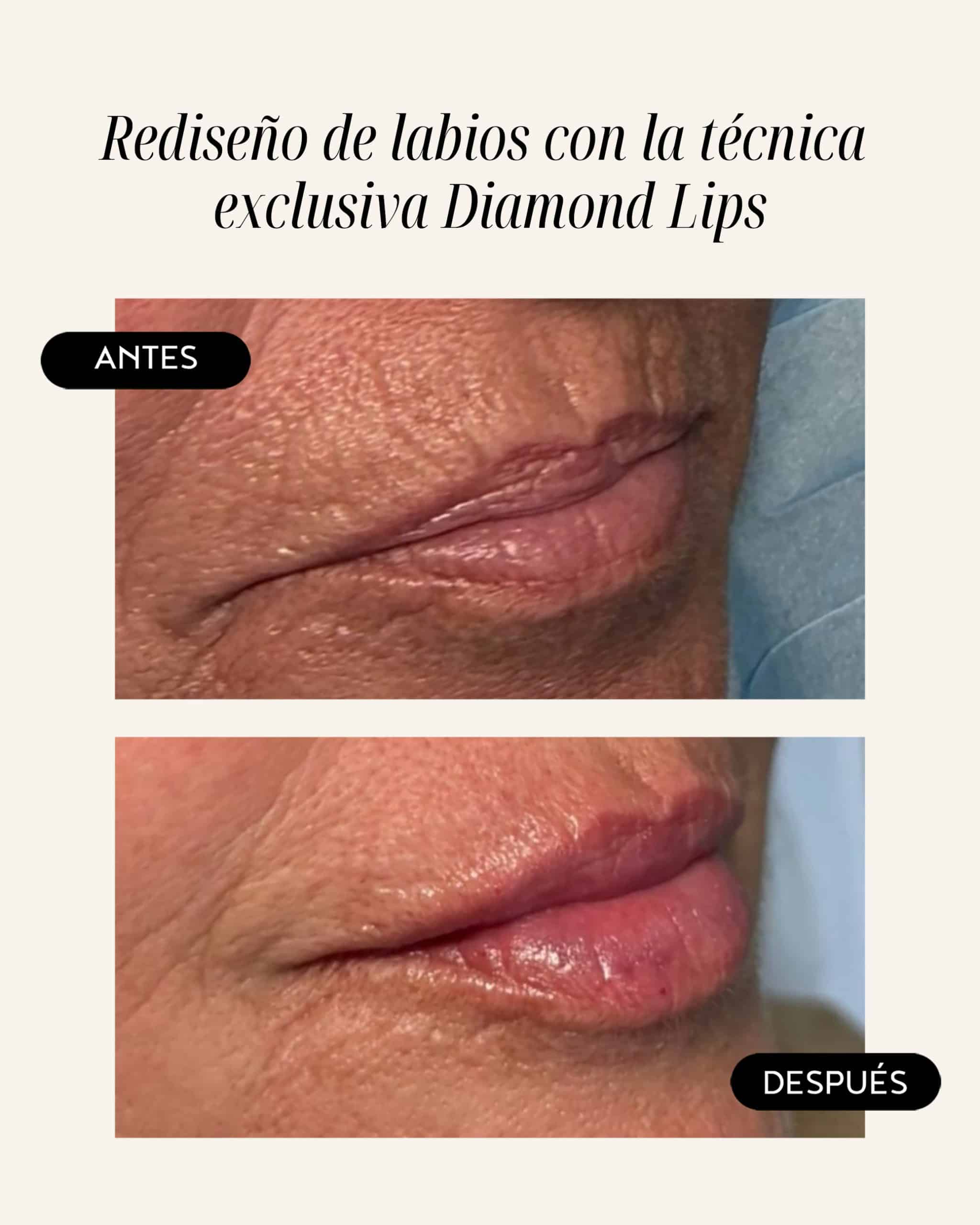 diamond-lips-07