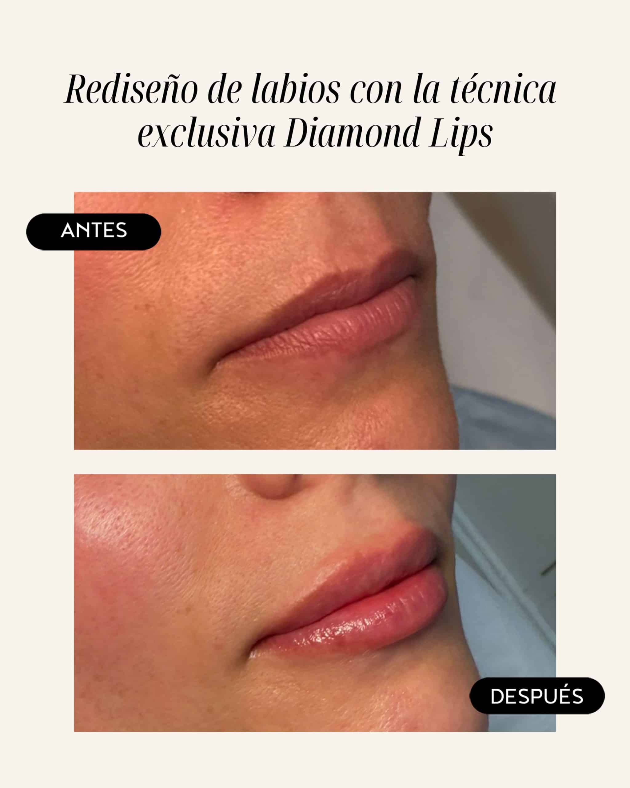 diamond-lips-08
