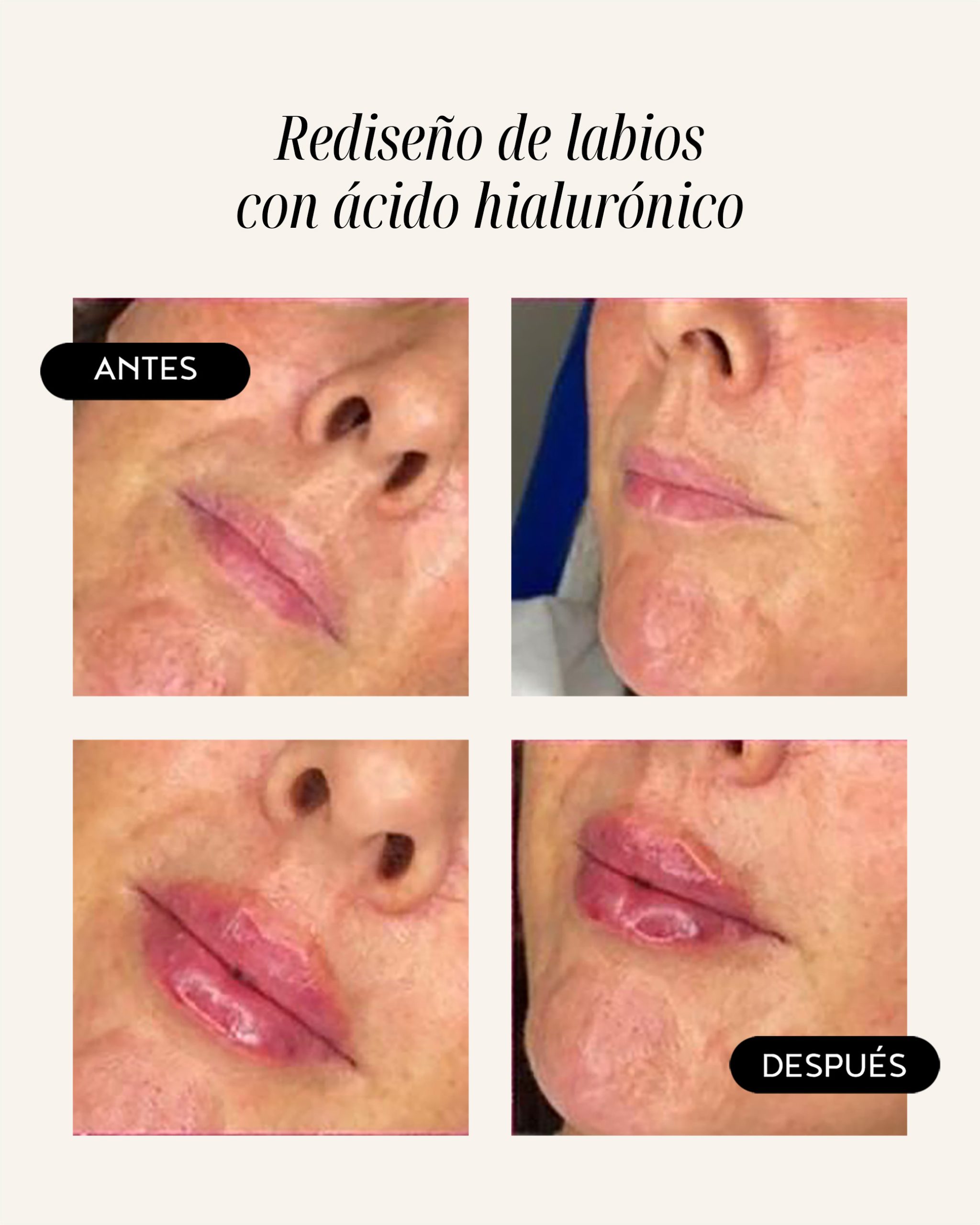 diamond-lips-09